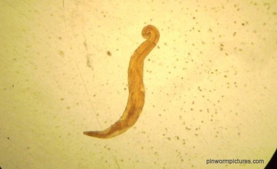 pin worm